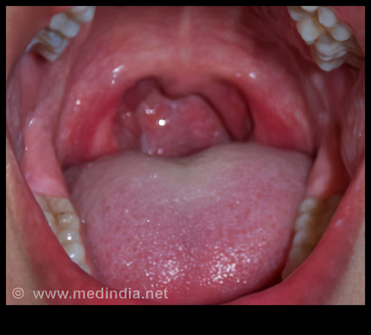 בלוטות טעם זעירות, פוטנציאל גדול: שליטה בתזונה לילדים